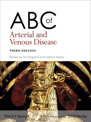 cover image of ABC of Arterial and Venous Disease